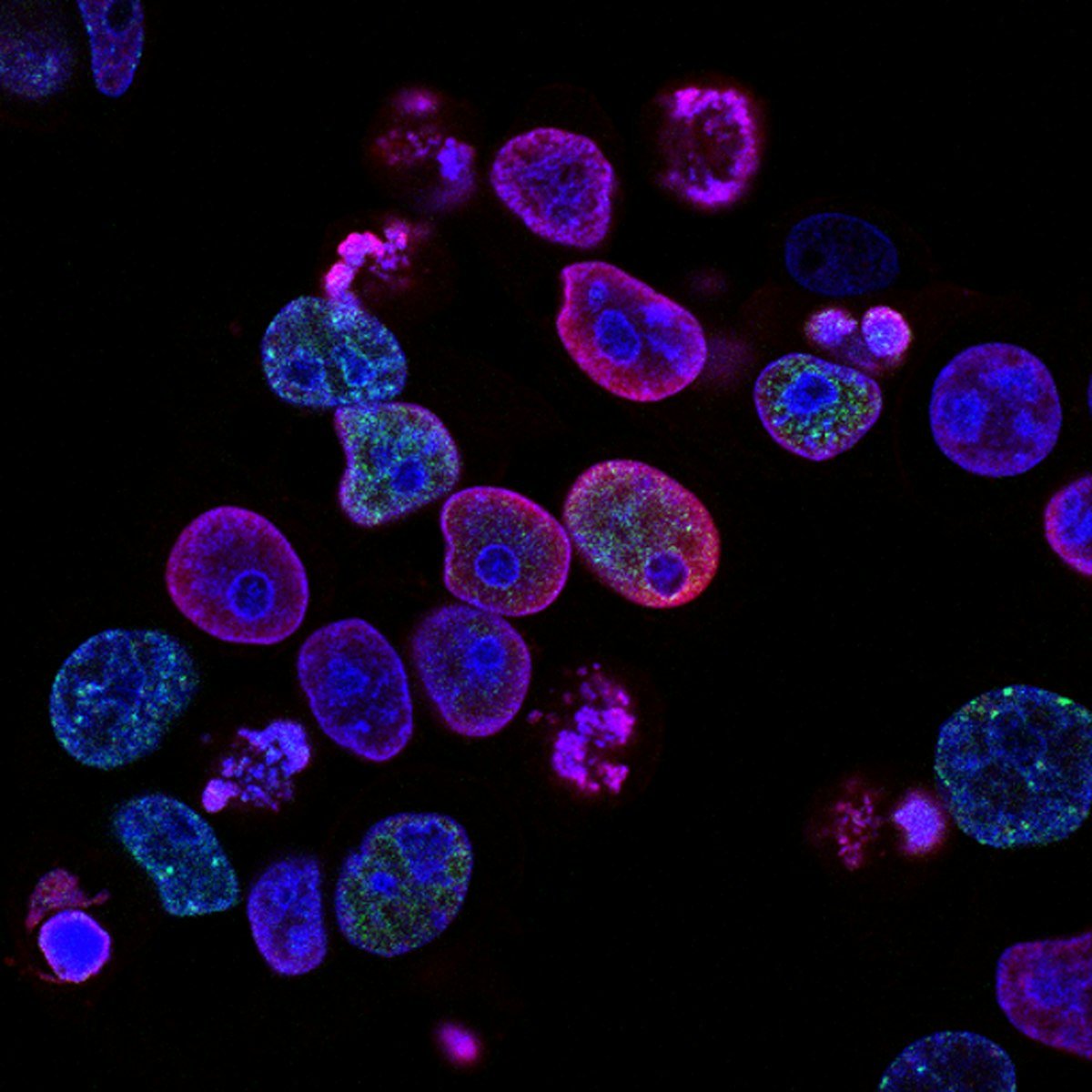 Oral microbiome bacteria