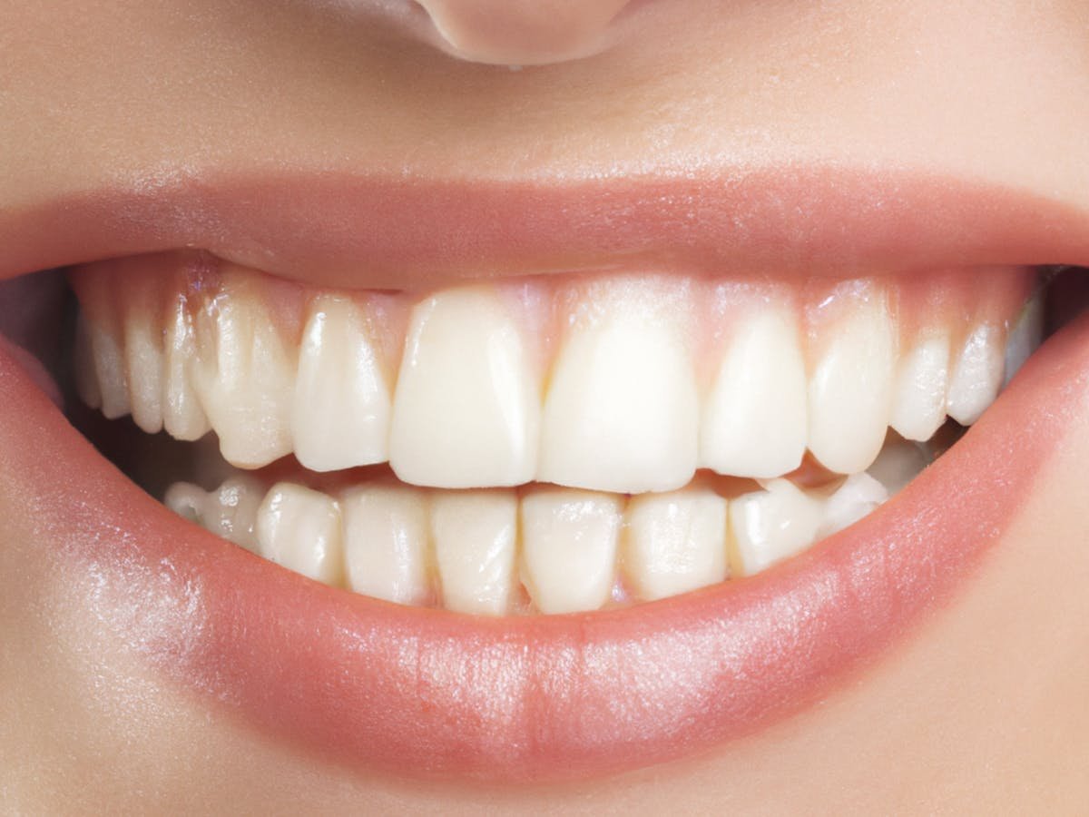 Close-up of healthy gums and teeth