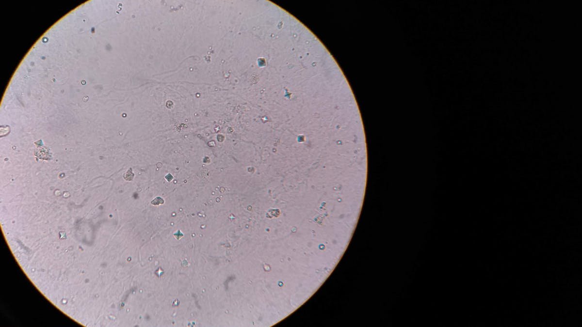 Microscopic view of oral bacteria